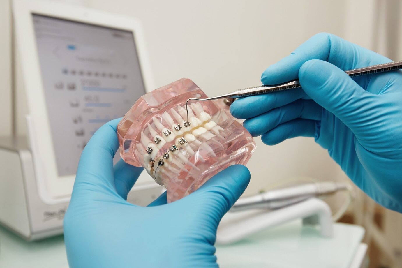 imgi 95 dentista sosteniendo modelo plastico dental aparatos ortopedicos 273609 13103